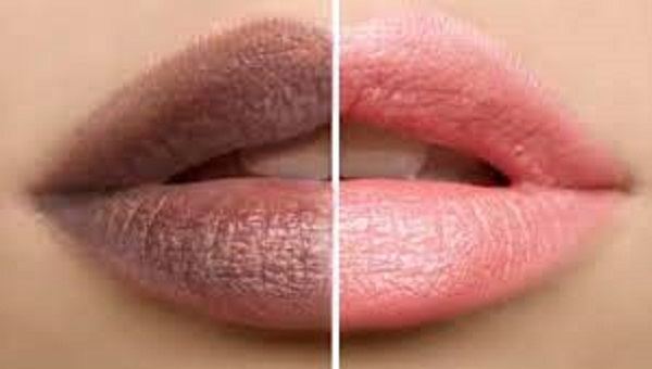 உங்கள் உதடுகள் இப்படி இருக்கா? அப்போ ஆபத்து!