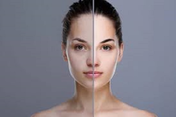 முகத்தில் உள்ள கருமை நீங்க வேண்டுமா?