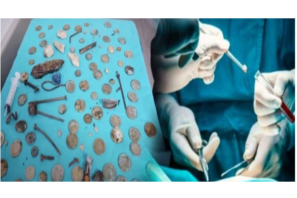 நபரின் வயிற்றுக்குள் இருந்த புதையல்!