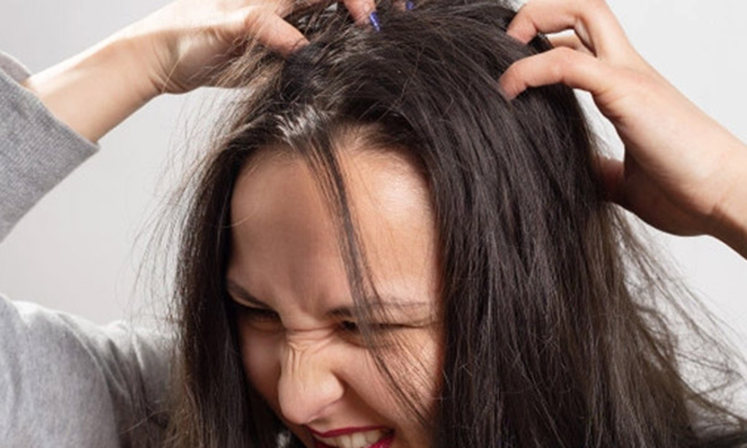 பேன் தொல்லையை போக்கும் வீட்டு வைத்தியம்