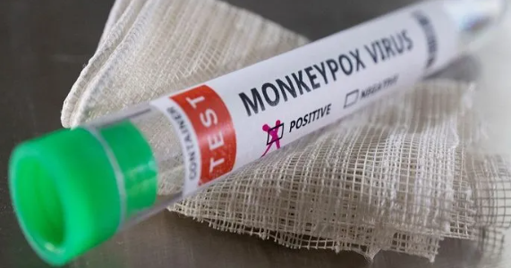 குரங்கு அம்மை நோயால் பாதிக்கப்பட்ட முதலாவது நபர் உயிரிழப்பு