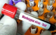 Monkeypox தொற்றாளர்களின் பரிசோதனைகள் நாளை முதல் ஆரம்பம்