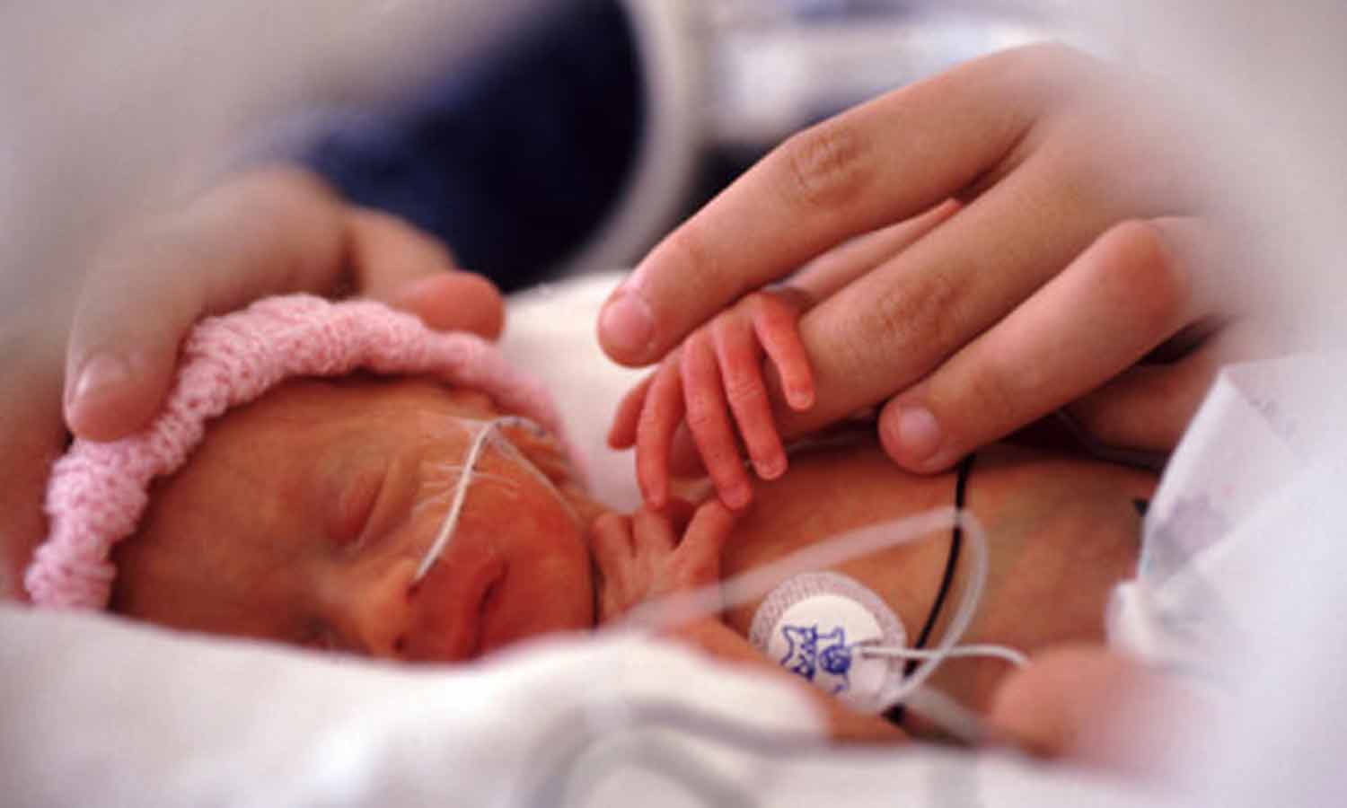 பிறந்த குழந்தைகளின் இறப்பிற்கு முக்கிய காரணமாகும் குறைப்பிரசவம்...