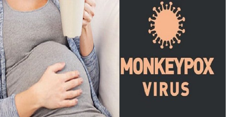 குரங்கு காய்ச்சலால் கர்ப்பிணிப் பெண்களுக்கு கருக்கலைப்பு ஏற்படலாம் – வைத்தியர் எச்சரிக்கை!