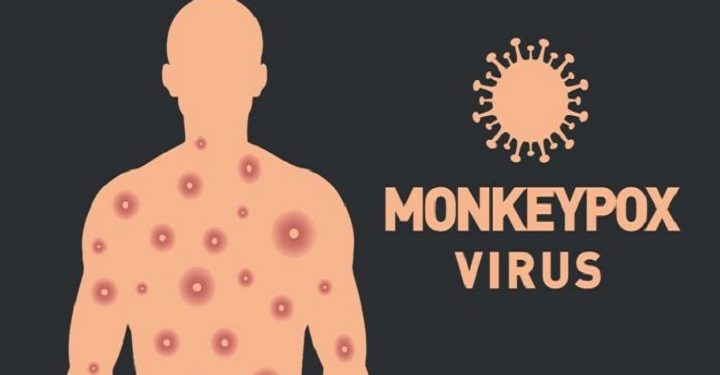 ஓரினச் சேர்க்கையில் ஈடுபடுபவர்களுக்கிடையில் குரங்கம்மை நோய் அதிகமாக பரவும் அபாயம்