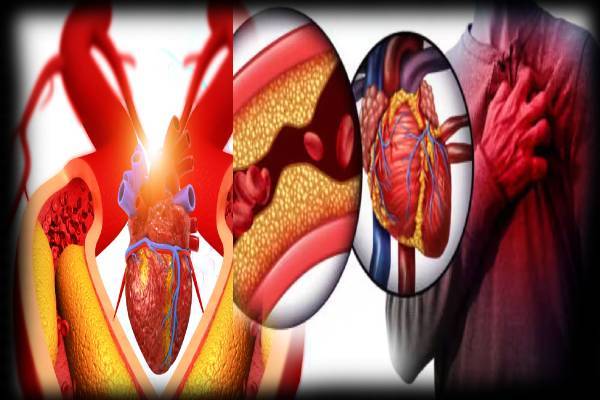 இந்த அறிகுறிகள் இருக்கா? அப்போ இரத்த குழாய் அடைப்பு அபாயம் உறுதி