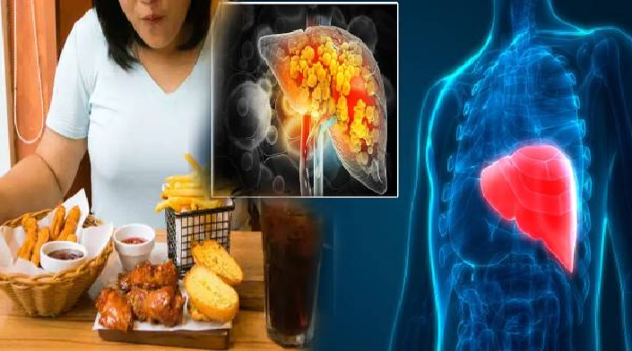 இந்த உணவுகளை அதிகமாக சாப்பிடுபவரா நீங்க? அப்போ கல்லீரல் ஆபத்து உறுதி