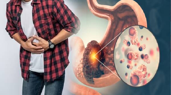 சாதாரண வயிற்று வலிக்கும் வயிற்று புற்றுநோய்க்கும் என்ன வித்தியாசம்? முழுசா தெரிஞ்சிக்கோங்க