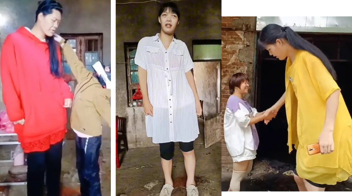 உலகின் உயரமான பெண் 23 வயதில் மரணம்: உயிரைப் பறித்த ஜலதோஷம்...