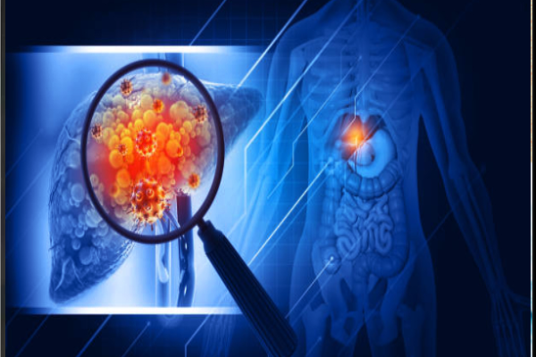 கல்லீரல் நோயினால் பாதிக்கப்பட்டால் முன்கூட்டியே இந்த அறிகுறிகள் காட்டுமாம்!