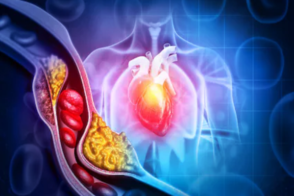 ஆபத்தான நிலைக்கு தள்ளும் கெட்ட கொழுப்பு எப்படி எளிதில் போக்கலாம்?