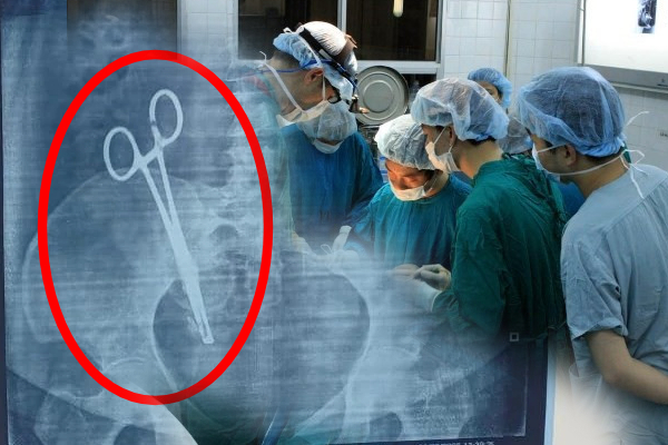 பெண் வயிற்றுக்குள் கத்தரிக்கோல்; 17 வருடங்களுக்கு பின் தெரிந்த உண்மை!