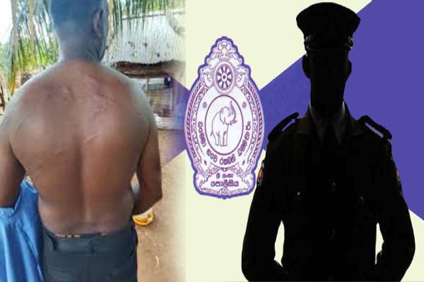இலங்கை பொலிஸாரின் அடாவடித்தனம் ; தீவிர சிகிச்சை பெரும் குடும்பஸ்தர்